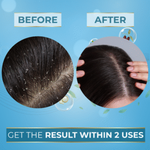 donoka professional banana protein shampoo with biotin, paraben & sulfate free, 300ml