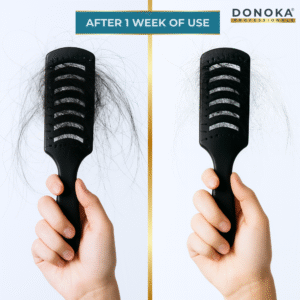 donoka biotin enriched anti hairfall shampoo – strengthens & reduces hair fall